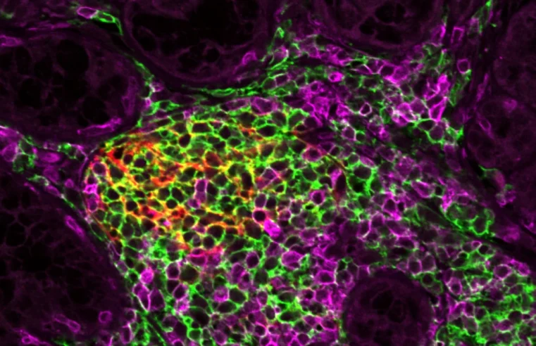 Understanding Immunology: The Body’s Defense System