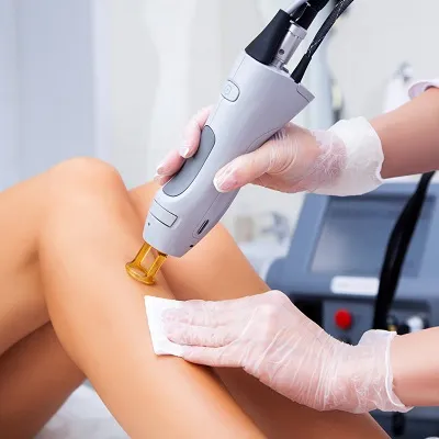 Can Laser Hair Removal Actually Cure “Strawberry Skin” For Good in North York, Toronto?